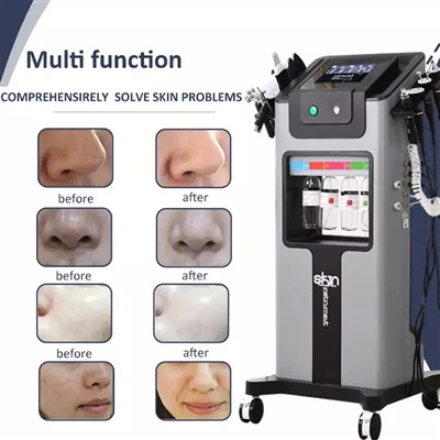Hydro Facial Tshuab Tuam Tshoj
