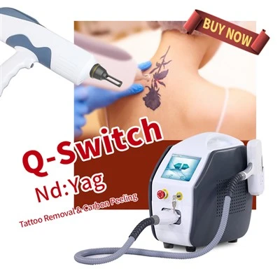 Tattoo Professional Tshem Tawm Laser Apparatus